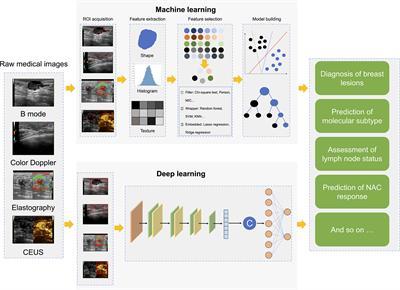 Ultrasound radiomics in personalized breast management: Current status and future prospects